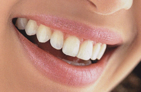 Cosmetic dentist in Delhi, cosmetic dental clinic in Delhi