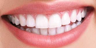 Cosmetic Smile Designing Delhi
