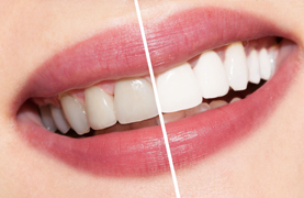 cosmetic dental clinic in South Delhi, dental clinic in South Delhi